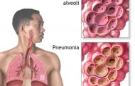 Young Children And Adults Above 65years Are Most Prone To Pneumonia